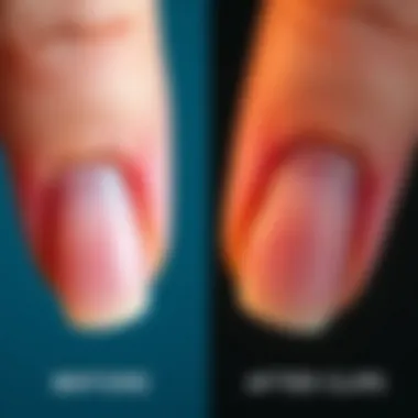 Comparison of nail condition before and after gel removal